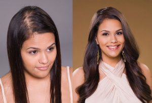 Postiche Lite Hair Volumiser
