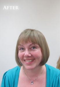 Hair Volumiser Before and After