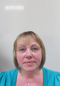 Hair Volumiser Before and After