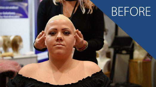 emma-before Postiche Lite Hair Volumiser Case Studies